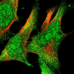 Cyclophilin 40 Antibody in Immunocytochemistry (ICC/IF)