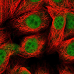MGMT Polyclonal Antibody