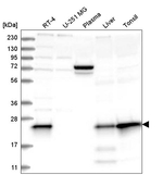MGMT Antibody in Western Blot (WB)