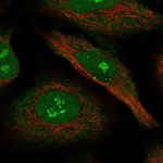 RIP140 Antibody in Immunocytochemistry (ICC/IF)