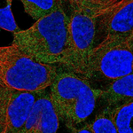 CaMKI Polyclonal Antibody