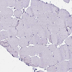 IFIT1 Antibody in Immunohistochemistry (Paraffin) (IHC (P))