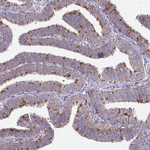 IFIT1 Antibody in Immunohistochemistry (Paraffin) (IHC (P))
