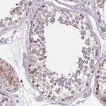IFIT1 Antibody in Immunohistochemistry (Paraffin) (IHC (P))