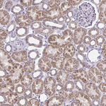 IFIT1 Antibody in Immunohistochemistry (Paraffin) (IHC (P))