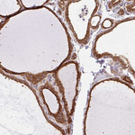 beta COP Antibody in Immunohistochemistry (Paraffin) (IHC (P))