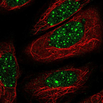 THRB Polyclonal Antibody