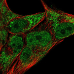 JARID2 Polyclonal Antibody