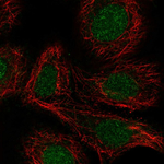 RARA Antibody in Immunocytochemistry (ICC/IF)