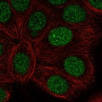 RARA Polyclonal Antibody