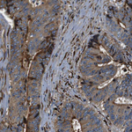 COL1A1 Antibody in Immunohistochemistry (Paraffin) (IHC (P))
