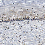 COL1A1 Antibody in Immunohistochemistry (Paraffin) (IHC (P))