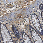 COL1A1 Antibody in Immunohistochemistry (Paraffin) (IHC (P))