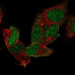 MSI1 Polyclonal Antibody