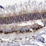 MSI1 Antibody in Immunohistochemistry (Paraffin) (IHC (P))