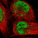 DNA Ligase I Polyclonal Antibody