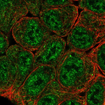 HIF-2 alpha Antibody in Immunocytochemistry (ICC/IF)