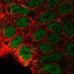HIF-2 alpha Antibody in Immunocytochemistry (ICC/IF)