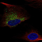 COL1A1 Polyclonal Antibody