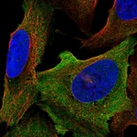 SCN8A Antibody in Immunocytochemistry (ICC/IF)