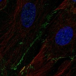 SCN8A Antibody in Immunocytochemistry (ICC/IF)