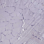 RANBP1 Antibody in Immunohistochemistry (Paraffin) (IHC (P))