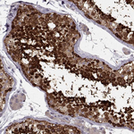 RANBP1 Antibody in Immunohistochemistry (Paraffin) (IHC (P))