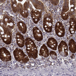 RANBP1 Antibody in Immunohistochemistry (Paraffin) (IHC (P))