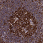 RANBP1 Antibody in Immunohistochemistry (Paraffin) (IHC (P))