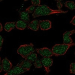 TdT Polyclonal Antibody