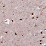 PSMC2 Antibody in Immunohistochemistry (Paraffin) (IHC (P))