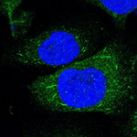 TNFRSF14 Antibody in Immunocytochemistry (ICC/IF)