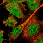 SMAD7 Polyclonal Antibody