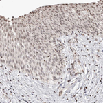 SMAD7 Antibody in Immunohistochemistry (Paraffin) (IHC (P))