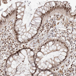 SMAD7 Antibody in Immunohistochemistry (Paraffin) (IHC (P))