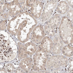 SMAD7 Antibody in Immunohistochemistry (Paraffin) (IHC (P))