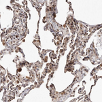 SMAD7 Antibody in Immunohistochemistry (Paraffin) (IHC (P))