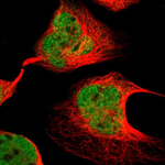 p300 Polyclonal Antibody