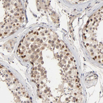 p300 Antibody in Immunohistochemistry (Paraffin) (IHC (P))