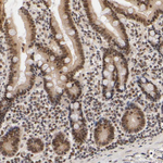 p300 Antibody in Immunohistochemistry (Paraffin) (IHC (P))