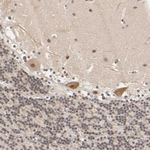 p300 Antibody in Immunohistochemistry (Paraffin) (IHC (P))