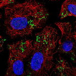 ATGL Polyclonal Antibody