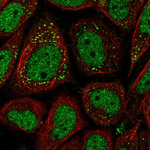 ATGL Polyclonal Antibody