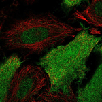 SRC1 Polyclonal Antibody