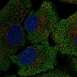 GSR Polyclonal Antibody