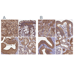 STUB1 Antibody in Immunohistochemistry (Paraffin) (IHC (P))