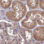 STUB1 Antibody in Immunohistochemistry (Paraffin) (IHC (P))