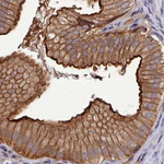 STUB1 Antibody in Immunohistochemistry (Paraffin) (IHC (P))