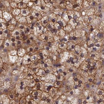 STUB1 Antibody in Immunohistochemistry (Paraffin) (IHC (P))