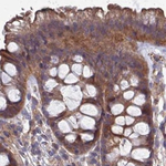 STUB1 Antibody in Immunohistochemistry (Paraffin) (IHC (P))